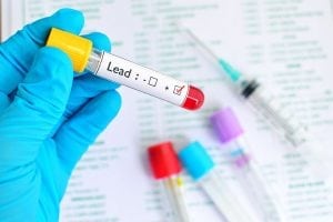 lead blood test