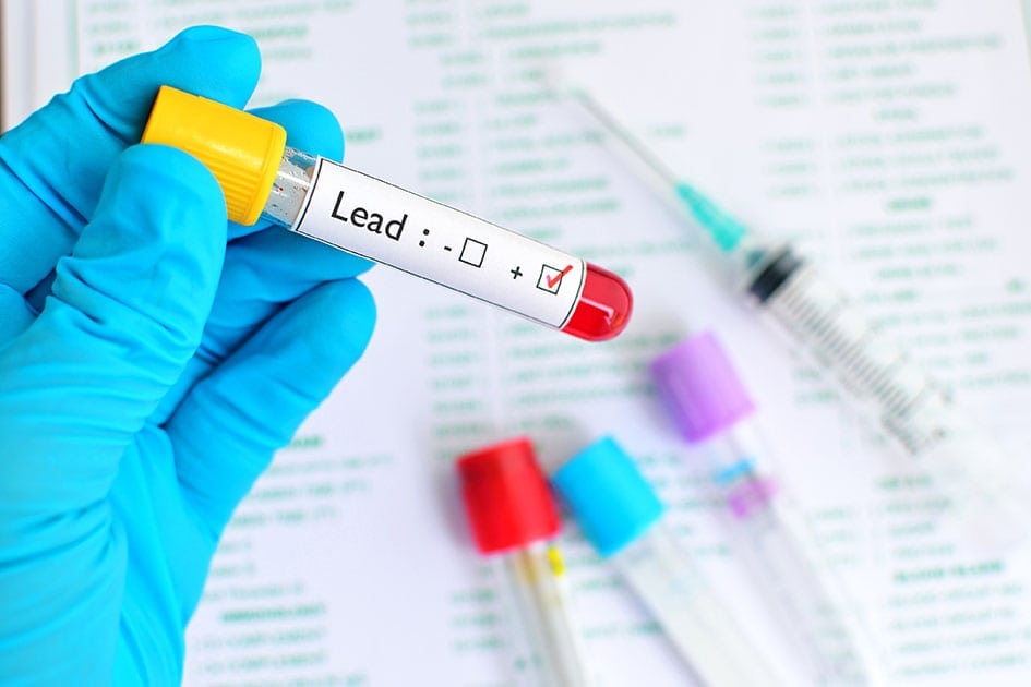 lead blood test EScrap News